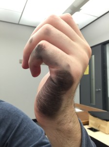 Left hand smudged